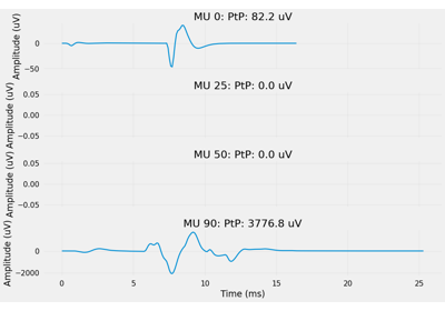 Intramuscular EMG Signals