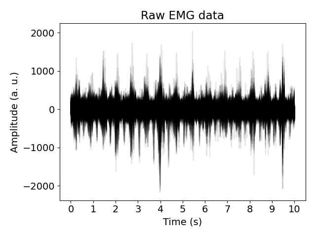 Raw EMG data